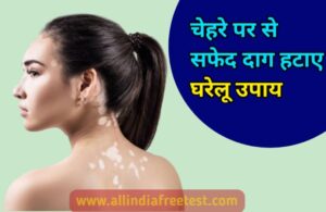 white spots and patches on skin hindi